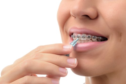 dental braces - Woman cleaning orthodontic in Dublin
